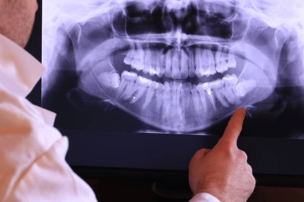 Best Emergency Cosmetic Dentistry in Woburn, MA